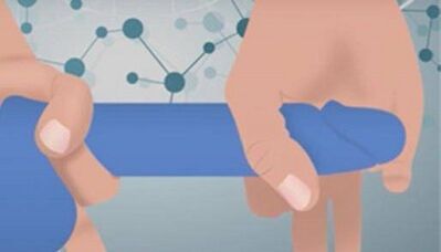 Technologie de saillie pour augmenter un membre